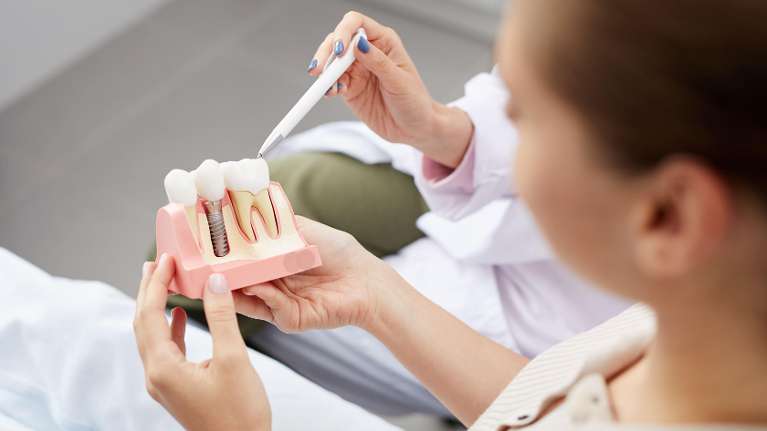 Dental Implants Adamstown